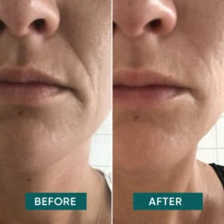 Patchs Rides De La Bouche Réutilisables I Love Your Smile - Apricot -AEGIS PHARMA 495