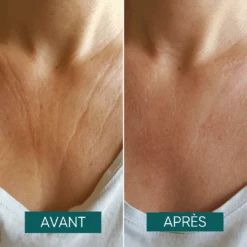 Patch Anti-rides Réutilisable Liberté Décolleté - Apricot -AEGIS PHARMA 510