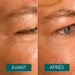 Patchs Yeux Et Tempes à L'aloe Vera Réutilisables Aloe There - Apricot 6 Patchs Yeux Et Tempes à L'aloe Vera Réutilisables Aloe There - Apricot -AEGIS PHARMA 549